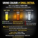 Urine Color is not small details